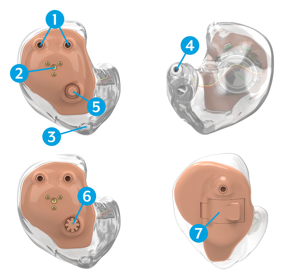 Hearing Aid Parts Diagram